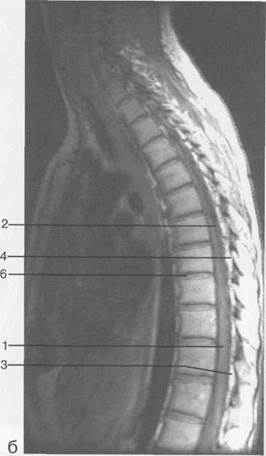 лучевая анатомия позвоночника и спинного мозга - student2.ru