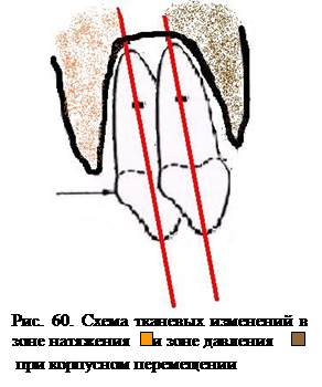 Биоморфологические изменения в тканях пародонта при горизонтальных перемещениях зубов - student2.ru