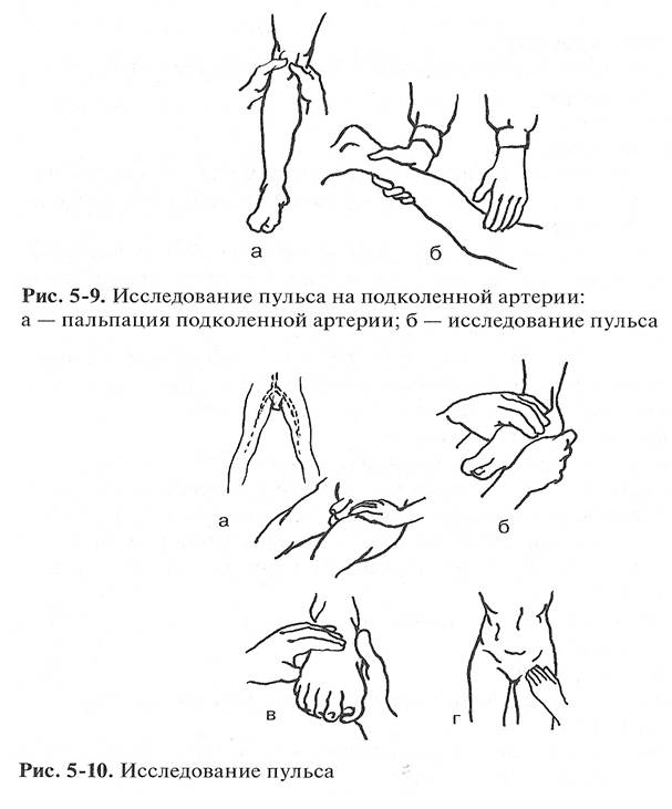 Измерения артериального давления. - student2.ru