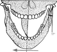 Изучение формы зубных рядов - student2.ru