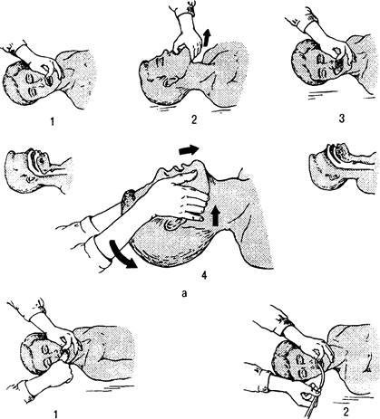 обеспечение проходимости дыхательных путей - student2.ru