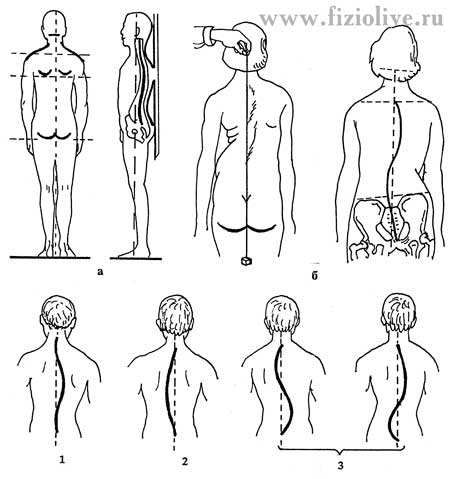 Определение искривления позвоночника - student2.ru