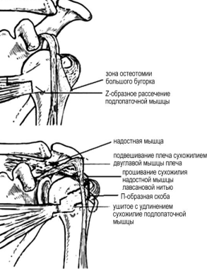 Показатели состояния мягких тканей области плечевого сустава - student2.ru