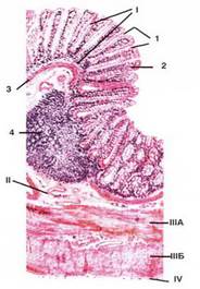 Препарат № 167 Толстая кишка. Окраска: гематоксилин- эозин. - student2.ru