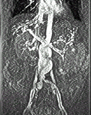Пример обработки рентгеновских биомедицинских изображений с использованием системы MATLAB - student2.ru
