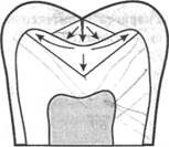 принципы и техника препарирования твердых тканей зуба при кариесе - student2.ru