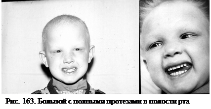 Протезирование детей в период временного прикуса - student2.ru