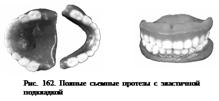 Съемные протезы - student2.ru