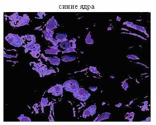 Шаг 6: Сегментация ядер на основании отдельного изображения - student2.ru