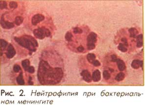 Старше 10 лет- 2-6*106 клеток/л. - student2.ru