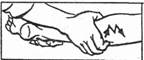 Техника вспомогательных приемов. Сотрясение — выполняется отдельными пальцами или кистями, движения производятся в различных направлениях и напоминают как бы просеивание муки через сито (рис - student2.ru