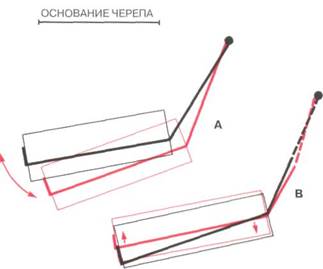 Терминология. Ротационные изменения в челюстях - student2.ru