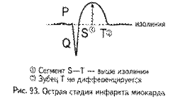 Электрокардиографические признаки инфаркта миокарда - student2.ru