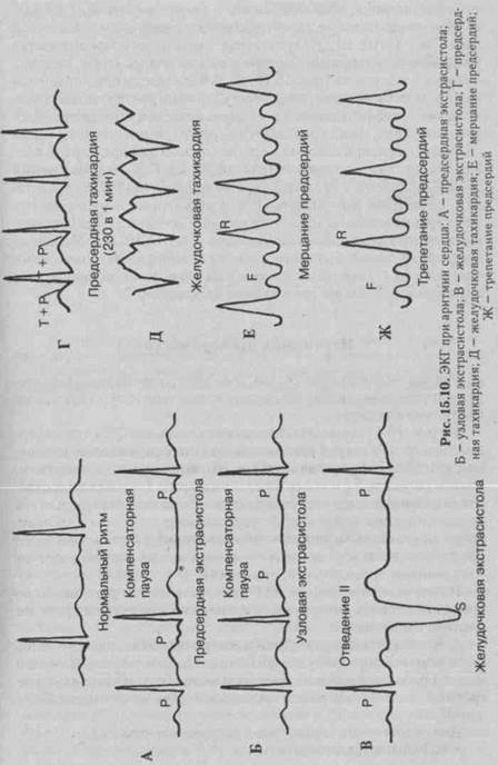 Зубцы и интервалы электрокардиограммы (ЭКГ) - student2.ru