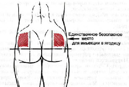 Алгоритм проведения пробы Манту - student2.ru