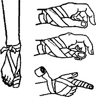 бинтовая повязка - student2.ru