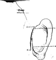 частичный отрыв ушной раковины - student2.ru