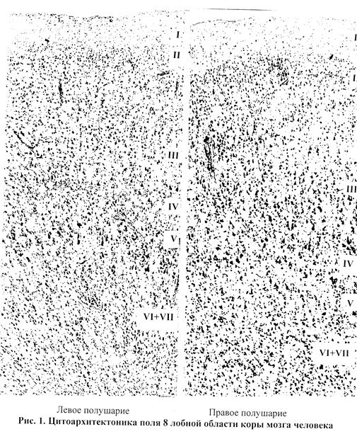 цитоархитектоническая асимметрия корковых полей и хвостатого ядра мозга человека - student2.ru