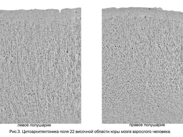 цитоархитектоническая асимметрия корковых полей и хвостатого ядра мозга человека - student2.ru