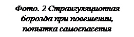 Действия сотрудников ИУ в случае обнаружения осужденного при попытке суицида (самоубийства) - student2.ru