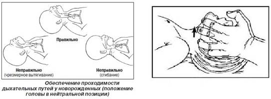 Диагностика клинической смерти - student2.ru