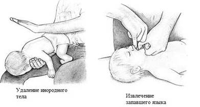 Диагностика клинической смерти - student2.ru