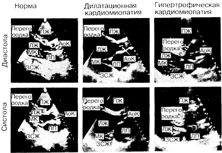 Фонокардиография, систолические временные интервалы и кривые пульса - student2.ru