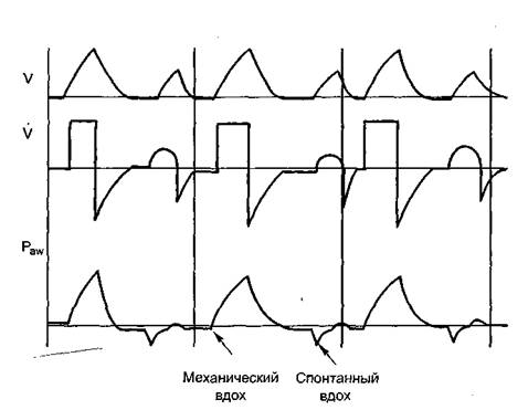 Глава 1. Принципы устройства респираторов - student2.ru