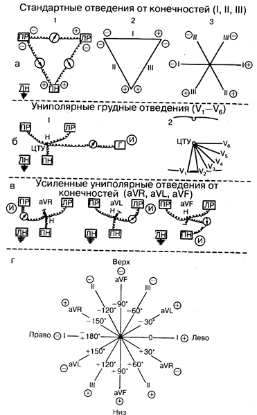 глава 178. электрокардиография - student2.ru