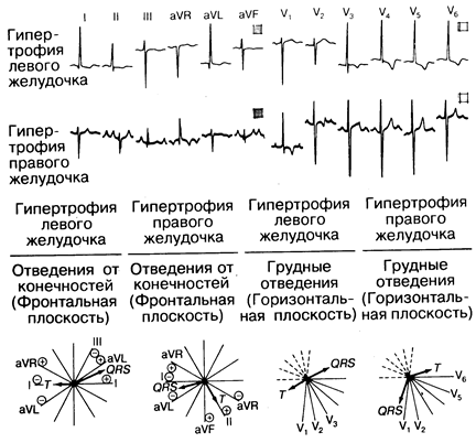 глава 178. электрокардиография - student2.ru