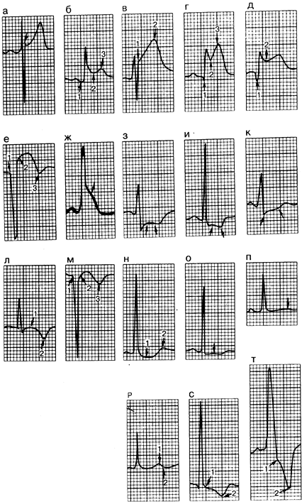 глава 178. электрокардиография - student2.ru