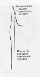 Ii. сосудистый фактор при заболеваниях позвоночника, оболочек и спинного мозга - student2.ru