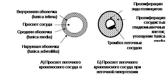 Интерстициальные заболевания легких - student2.ru