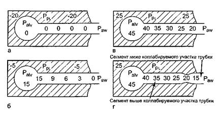 ивл при острой бронхообструкции и хобл - student2.ru