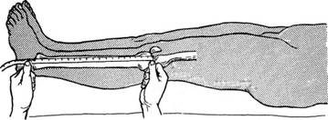 Измерение длины бедра, голени, плеча и предплечья. - student2.ru