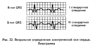 нормальная электрокардиограмма - student2.ru