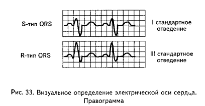 нормальная электрокардиограмма - student2.ru