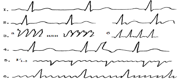 нормальная электрокардиограмма - student2.ru