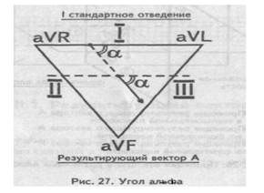 нормальная электрокардиограмма - student2.ru