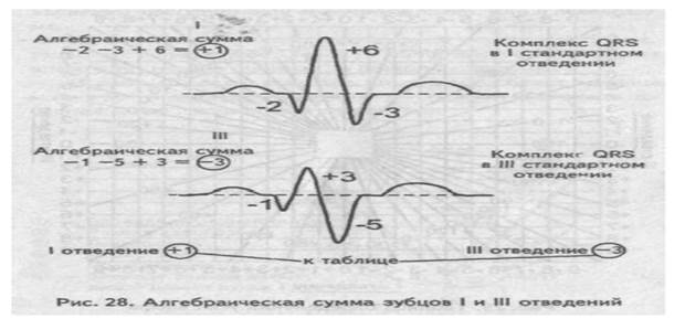 нормальная электрокардиограмма - student2.ru