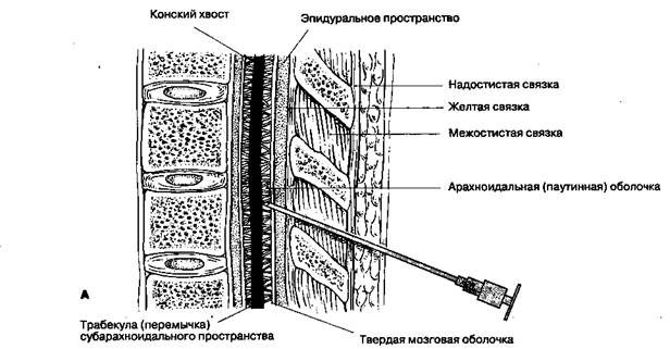 Каковы относительные противопоказания к быстрой последовательной индукции анестезии? - student2.ru