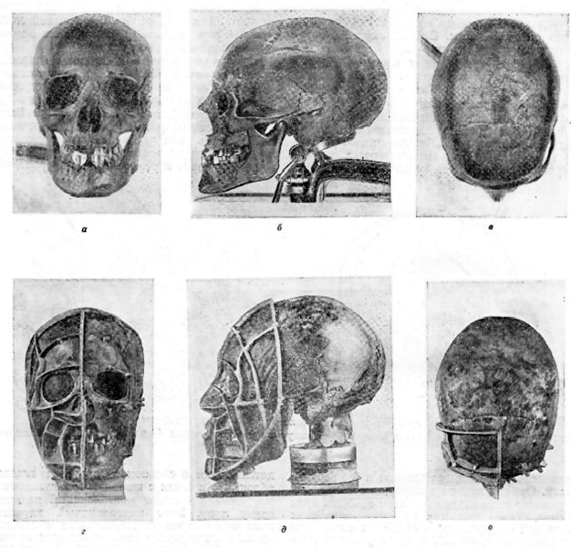 Измерения черепа Андрея Боголюбского по В.В. Гинзбургу - student2.ru