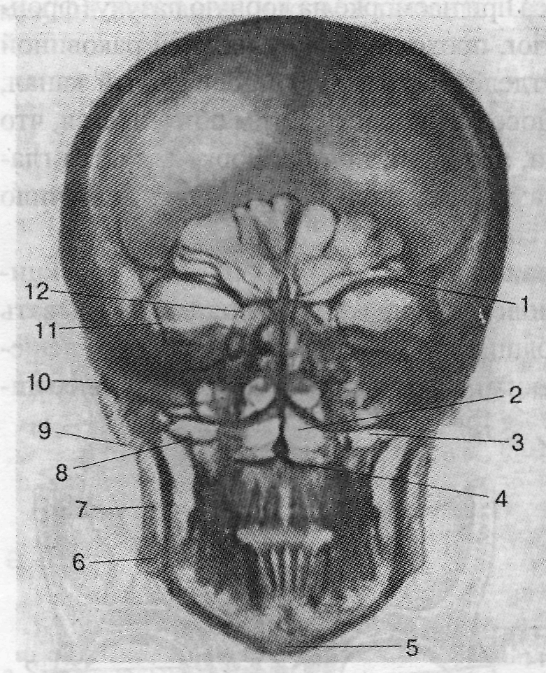 Рентгеноанатомия черепа - student2.ru