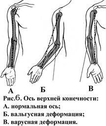 Особенности обследования больного с повреждениями опорно-двигательного аппарата - student2.ru