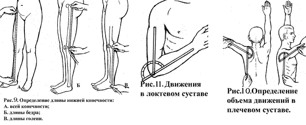 Особенности обследования больного с повреждениями опорно-двигательного аппарата - student2.ru