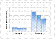 Down's syndrome: trisomy 21 - student2.ru