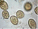 Echinococcus granulosis (эхинококк) - student2.ru