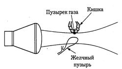 Факторы и артефакты, определяющие интенсивность принимаемого УЗ - student2.ru