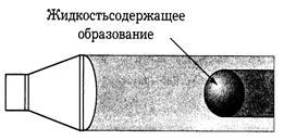 Факторы и артефакты, определяющие интенсивность принимаемого УЗ - student2.ru