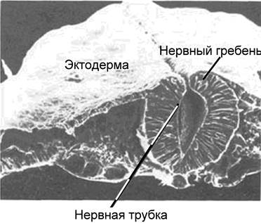 Факторы, влияющие на нейрогенез - student2.ru